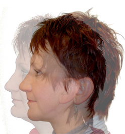 Gesichtschirurgie: Profilvergleich