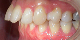 Vor Gesichtschirurgie Patient linke Seite