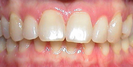 Vor Gesichtschirurgie Patient frontal Ansicht