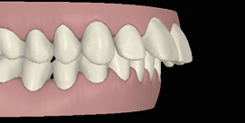 Vor Gesichtschirurgie digitale Ansicht rechte Seite