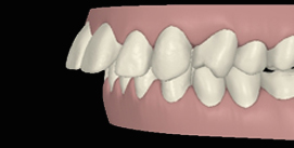 Vor Gesichtschirurgie digitale Ansicht linke Seite