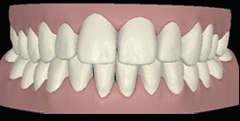 Vor Gesichtschirurgie digitale Ansicht frontal