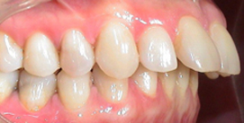 vor Gesichtschirurgie Patient rechte Seite