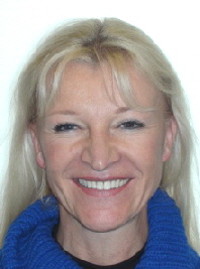 Invisalign_Engstand-2