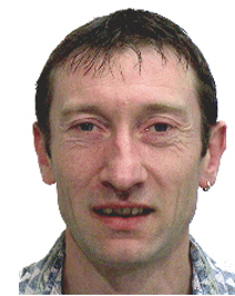 Unterkieferchirurgie 1