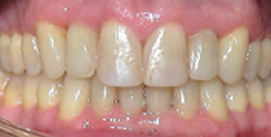 Unterkieferchirurgie 12