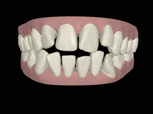 Digitale Animation Engstand
