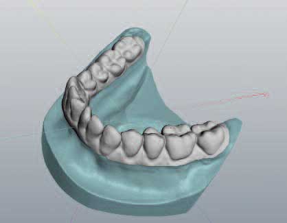dvt digitale Abdrucknahme