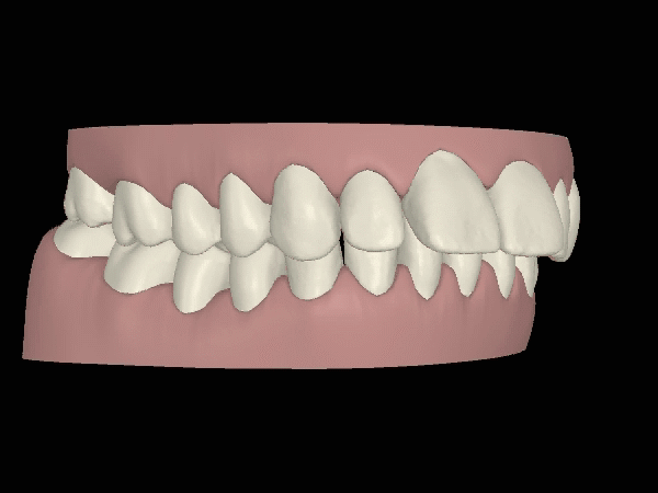 Gesichtschirurgie Animation
