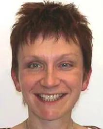 vor Invisalign-Gesichtschirurgie