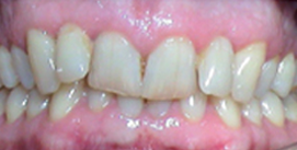 vor Behandlungsbeginn frontal Patient