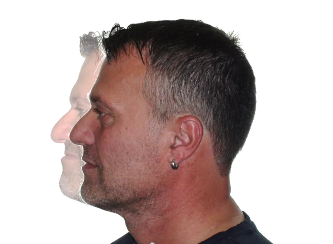 Profil medi ligner